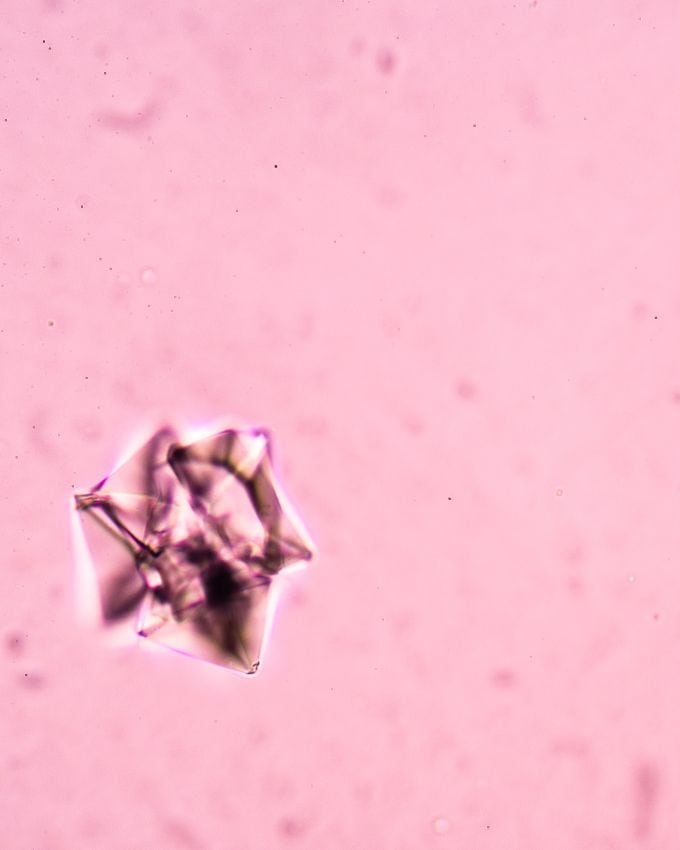 Oxalate