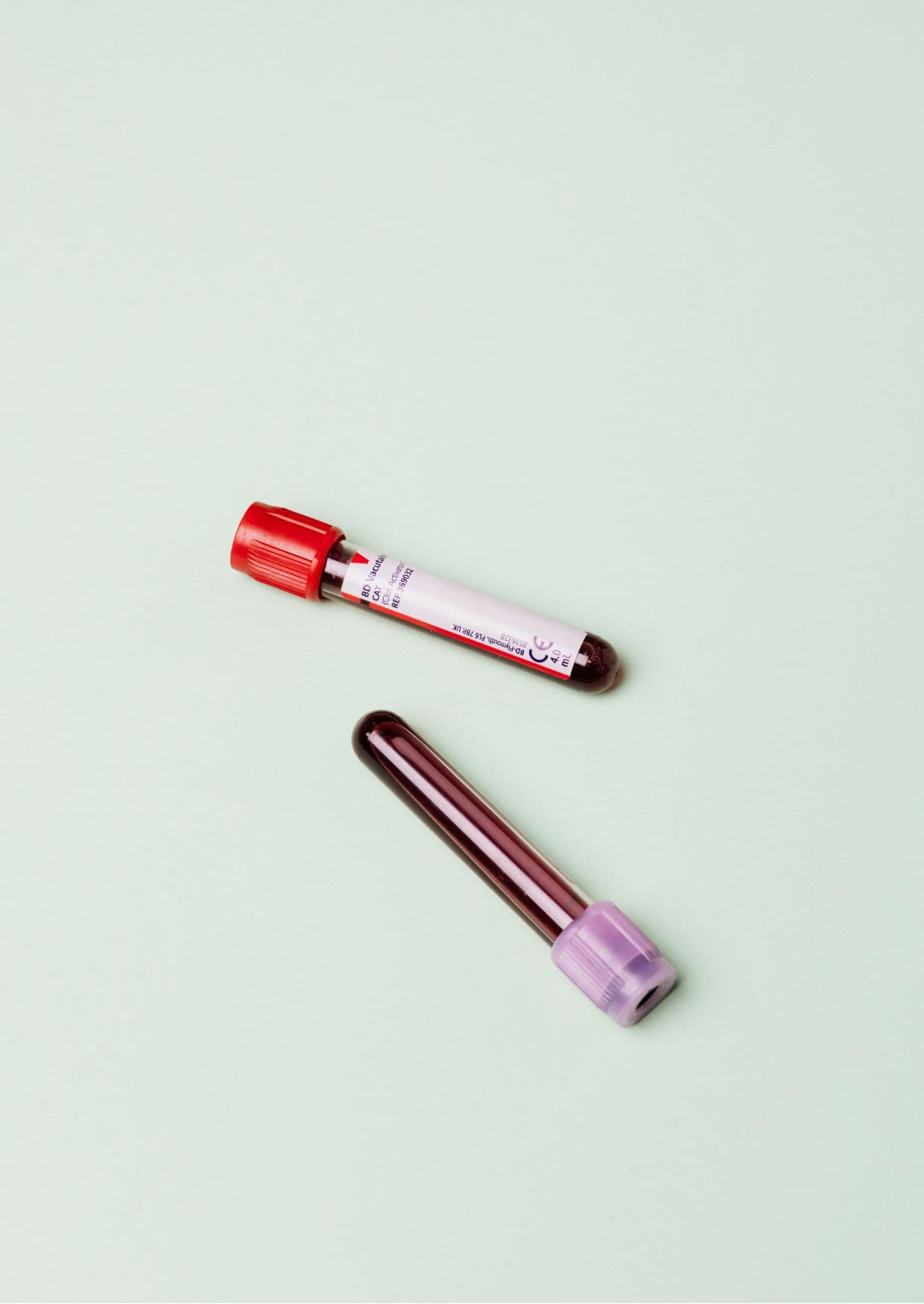 Langzeitzucker Hämoglobin A1c