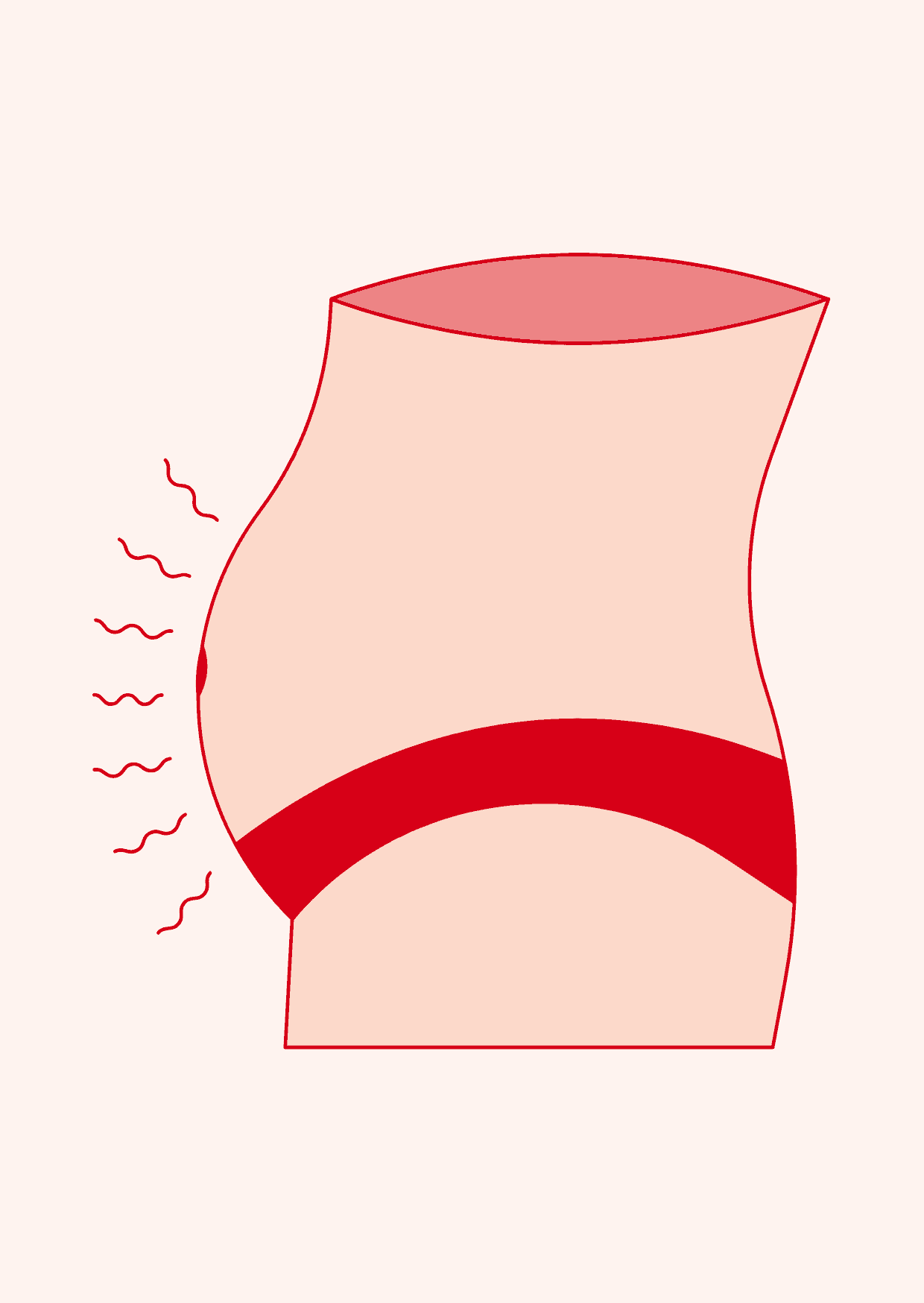 Blähbauch