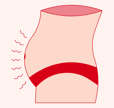 Blähbauch