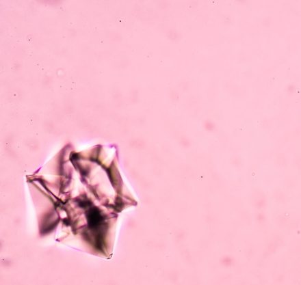 Oxalate in Urin
