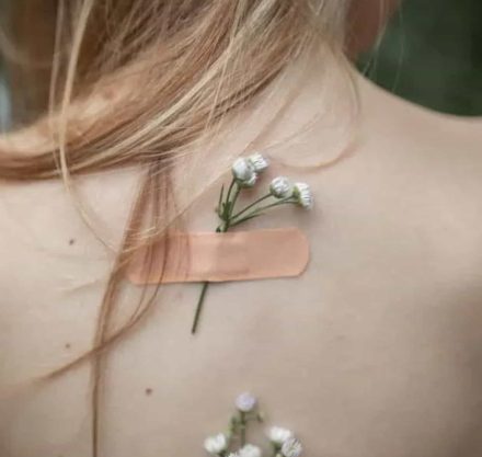 Frau mit Blumen und Pflaster auf dem Rücken